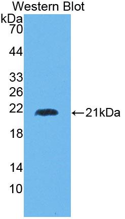 Polyclonal Antibody to Hyaluronan Mediated Motility Receptor (HMMR)