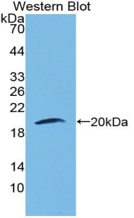 Polyclonal Antibody to Laminin Beta 3 (LAMb3)