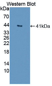 Polyclonal Antibody to Deoxyribonuclease II (DNASEII)