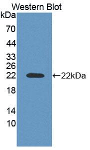 Polyclonal Antibody to Adrenocortical Dysplasia Homolog (ACD)