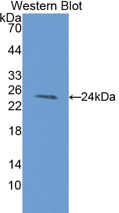 Polyclonal Antibody to Anterior Gradient 2 (AGR2)