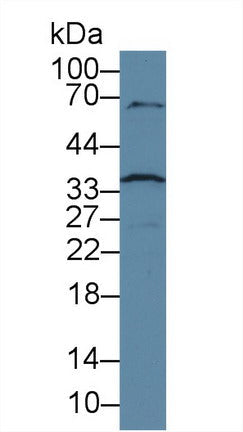 Polyclonal Antibody to Caspase 6 (CASP6)