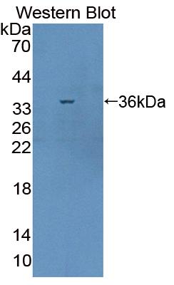 Polyclonal Antibody to Calcineurin Binding Protein 1 (CABIN1)