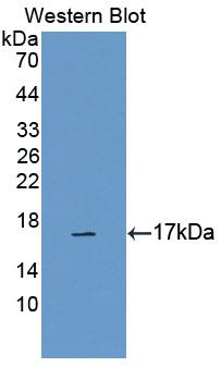 Polyclonal Antibody to Calcitonin Receptor (CTR)