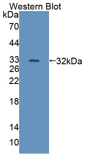 Polyclonal Antibody to Dishevelled Associated Activator Of Morphogenesis 1 (DAAM1)