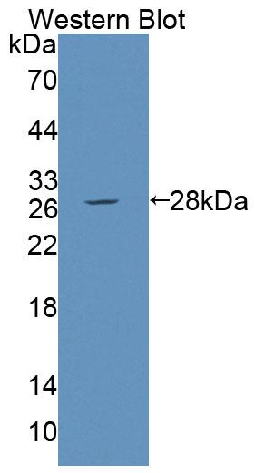 Polyclonal Antibody to Dystonin (DST)