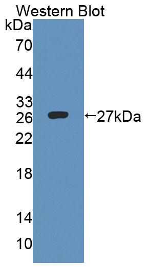 Polyclonal Antibody to Cytosolic Ovarian Carcinoma Antigen 1 (COVA1)