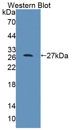 Polyclonal Antibody to Cytosolic Ovarian Carcinoma Antigen 1 (COVA1)