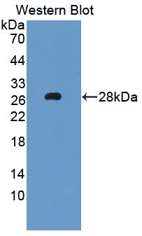 Polyclonal Antibody to Fas Activated Serine/Threonine Kinase (FASTK)