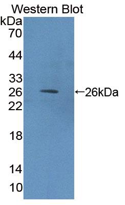 Polyclonal Antibody to Friend Leukemia Virus Integration 1 (FLI1)