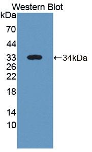 Polyclonal Antibody to Intestinal Cell Kinase (ICK)