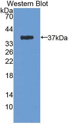 Polyclonal Antibody to Intestinal Cell Kinase (ICK)