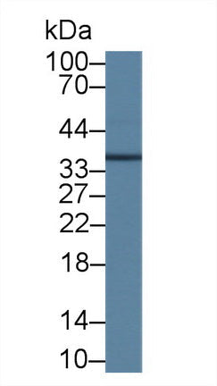 Polyclonal Antibody to Mitochondrial Uncoupling Protein 2 (UCP2)