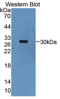 Polyclonal Antibody to Beta-ureidopropionase (UPB1)