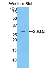 Polyclonal Antibody to Multimerin 1 (MMRN1)