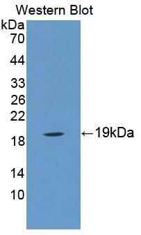 Polyclonal Antibody to Metaxin 1 (MTX1)