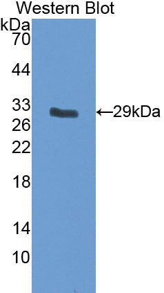 Polyclonal Antibody to Insulin Like Growth Factor Binding Protein 5 (IGFBP5)