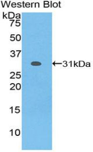 Polyclonal Antibody to Nicastrin (NCSTN)