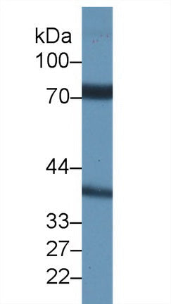 Polyclonal Antibody to Nicastrin (NCSTN)