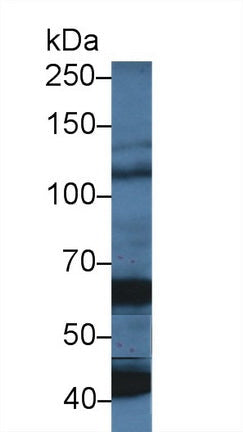 Polyclonal Antibody to 2',5'-Oligoadenylate Synthetase 1 (OAS1)