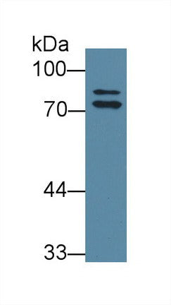 Polyclonal Antibody to Osteosarcoma Amplified 9 (OS9)