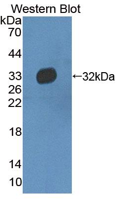 Polyclonal Antibody to Twinkle Protein, Mitochondrial (TWINL)