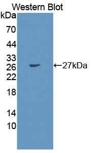 Polyclonal Antibody to Peroxisomal Biogenesis Factor 1 (PEX1)
