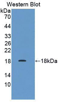Polyclonal Antibody to Prefoldin Subunit 1 (PFDN1)