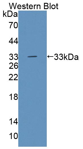Polyclonal Antibody to Tec Protein Tyrosine Kinase (TEC)
