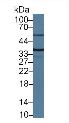 Polyclonal Antibody to Transmembrane Protease, Serine 2 (TMPRSS2)