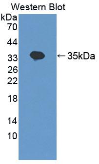 Polyclonal Antibody to Trinucleotide Repeat Containing Protein 6A (TNRC6A)