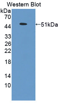 Polyclonal Antibody to Sclerostin (SOST)