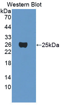 Polyclonal Antibody to Crystallin Gamma F (CRYgF)