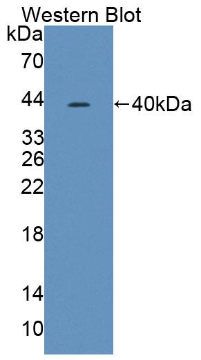 Polyclonal Antibody to Threonyl tRNA Synthetase (TARS)
