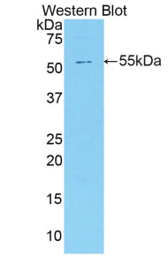 Polyclonal Antibody to Neutral Sphingomyelinase (NSMASE)