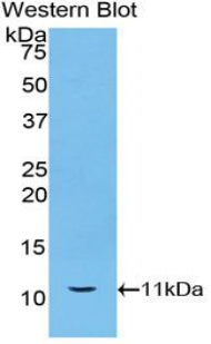Polyclonal Antibody to Heat Shock 70kDa Protein 8 (HSPA8)