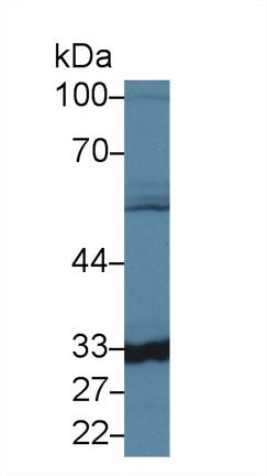 Polyclonal Antibody to Carbonic Anhydrase VB, Mitochondrial (CA5B)