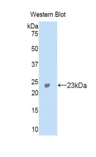 Polyclonal Antibody to Carbonic Anhydrase VA (CA5A)