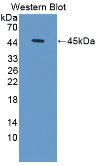 Polyclonal Antibody to Hemoglobin Delta (HBd)