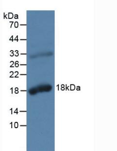 Polyclonal Antibody to Kallikrein 2 (KLK2)