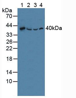 Polyclonal Antibody to Sequestosome 1 (SQSTM1)