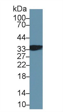 Polyclonal Antibody to Troponin T Type 1, Slow Skeletal (TNNT1)