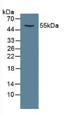 Polyclonal Antibody to Calcium/Calmodulin Dependent Protein Kinase II Alpha (CAMK2a)