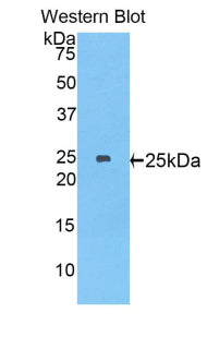 Polyclonal Antibody to Myosin Heavy Chain 8, Skeletal Muscle, Perinatal (MYH8)