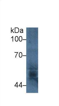 Polyclonal Antibody to Cytochrome P450 11A1 (CYP11A1)
