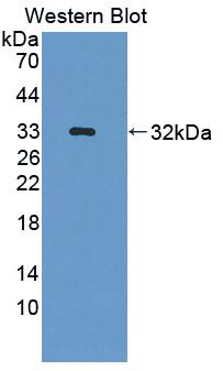 Polyclonal Antibody to Protein Tyrosine Phosphatase, Non Receptor Type 7 (PTPN7)