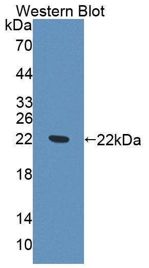 Polyclonal Antibody to ATP Binding Cassette Transporter E1 (E1)