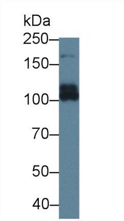Polyclonal Antibody to ATP Binding Cassette Transporter C6 (C6)