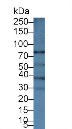Polyclonal Antibody to ATP Binding Cassette Transporter B5 (B5)