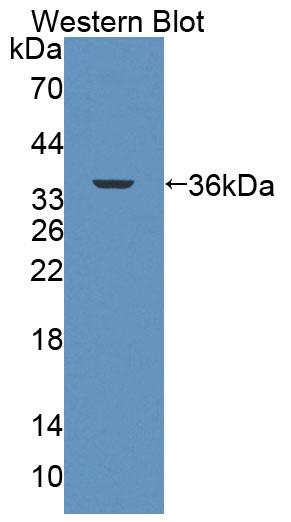 Polyclonal Antibody to ATP Binding Cassette Transporter B7 (B7)